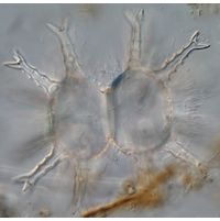 Staurastrum arctiscon