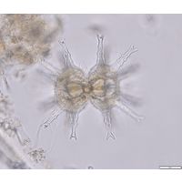 Staurastrum arctiscon