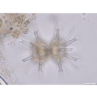 Staurastrum arctiscon