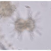 Staurastrum arctiscon