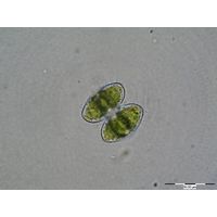 Staurastrum bieneanum