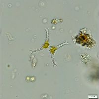 Staurastrum bloklandiae