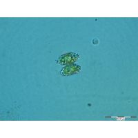 Staurastrum bohlinianum
