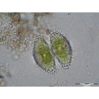 Staurastrum brebissonii