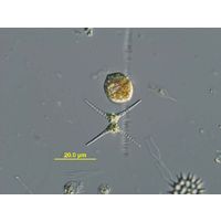 Staurastrum chaetoceras