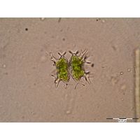 Staurastrum furcatum