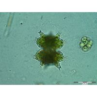 Staurastrum furcigerum