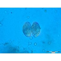 Staurastrum lapponicum