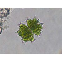 Staurastrum monticulosum