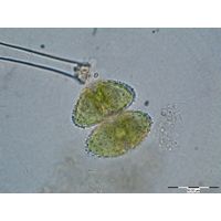 Staurastrum muricatum