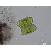Staurastrum oligacanthum
