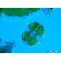 Staurastrum orbiculare