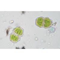 Staurastrum polonicum