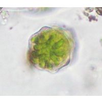 Staurastrum polonicum