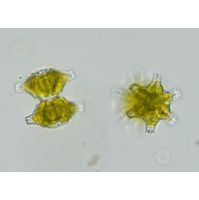 Staurastrum sexcostatum