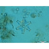Staurastrum sexcostatum