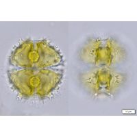 Staurastrum spongiosum