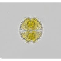 Staurastrum spongiosum