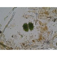 Staurastrum spongiosum