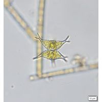 Staurastrum subcruciatum