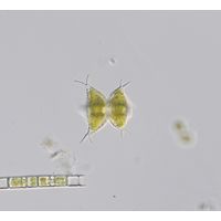 Staurastrum subcruciatum