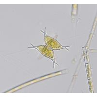 Staurastrum subcruciatum