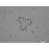 Staurastrum teliferum