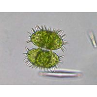 Staurastrum teliferum