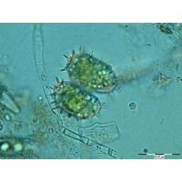 Staurastrum teliferum