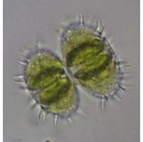 Staurastrum teliferum