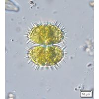 Staurastrum teliferum
