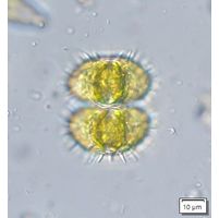 Staurastrum teliferum