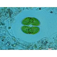 Staurodesmus convergens