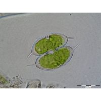 Staurodesmus convergens