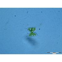 Staurodesmus extensus