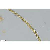 Teilingia granulata