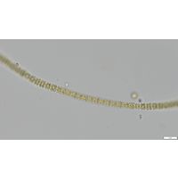 Teilingia granulata