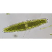 Tetmemorus granulatus