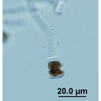 Vincularia roraimae