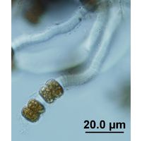 Vincularia roraimae