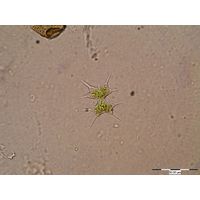 Xanthidium octocorne