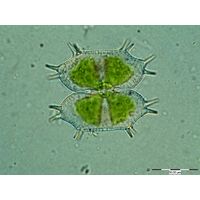 Xanthidium antilopeum