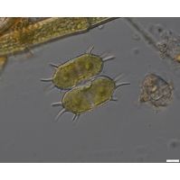 Xanthidium antilopaeum