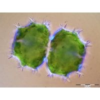 Xanthidium armatum