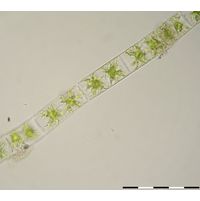 Zygnema