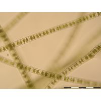 Zygnema