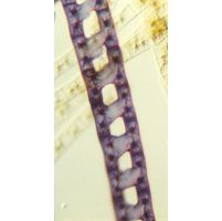 Zygnema
