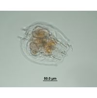 Brachionus angularis