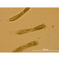 Ophrydium sp.