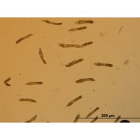 Ophrydium sp.